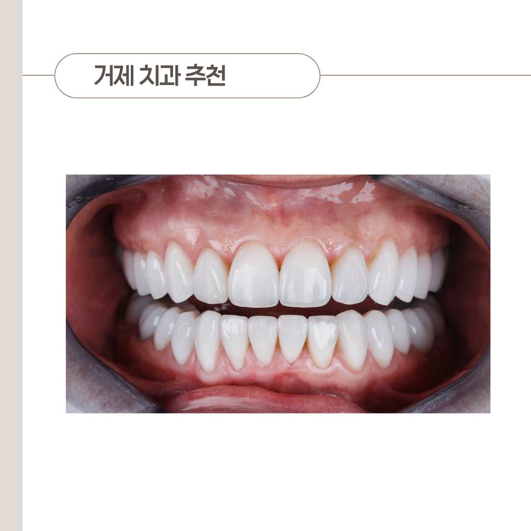 고현 치과&amp;#44; 나에게 맞는 곳 찾는 방법 팁