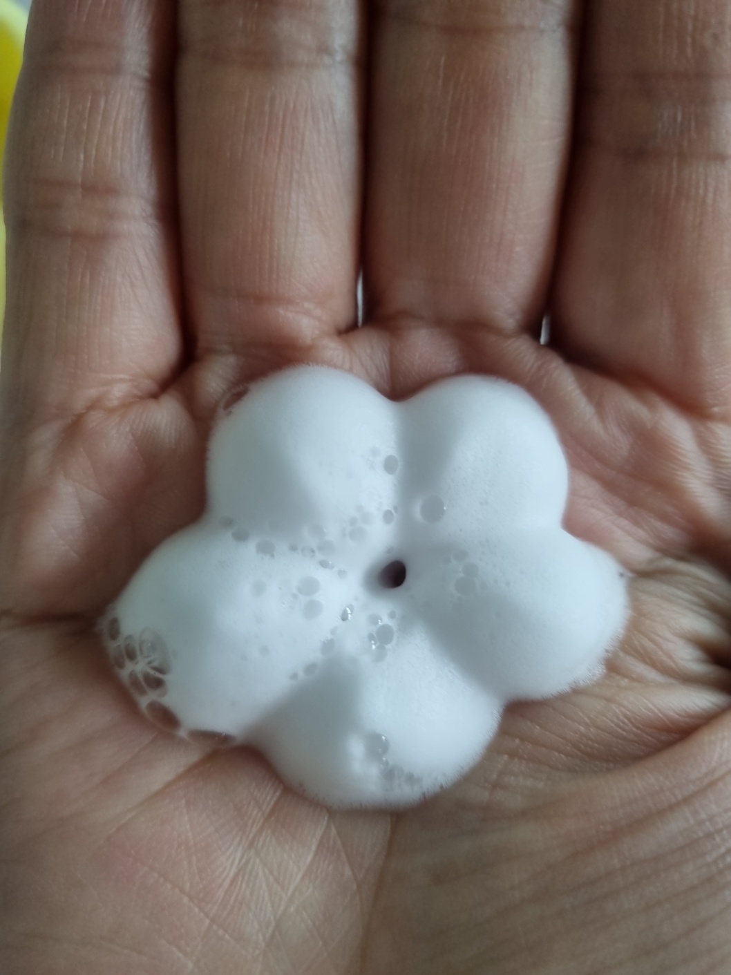 일본여행전염병 STSS 지역 증상 및 예방법