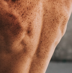 아보카도 오일 : 피부 개선