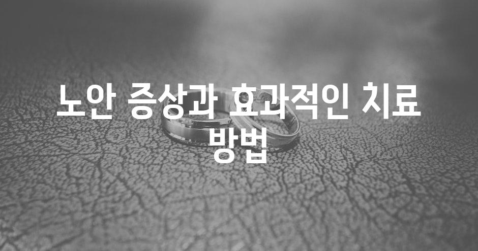 샘플 (68)