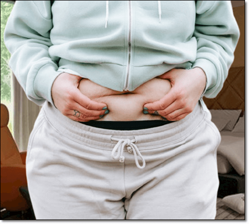 대사증후군 여성