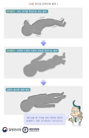 희귀질환 리이 증후군