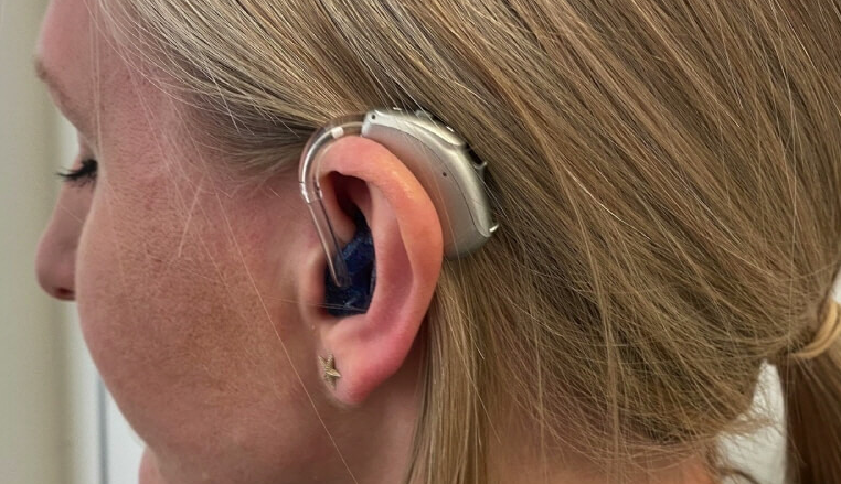 보청기 정부지원금 신청 총정리