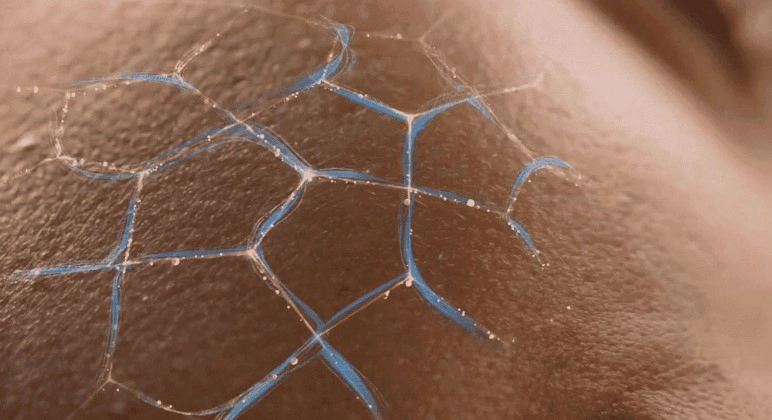 밀크 세라마이드 효능 