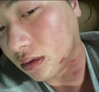 임혜동 전 야구선수 류현진 엉덩이 공갈협박 논란