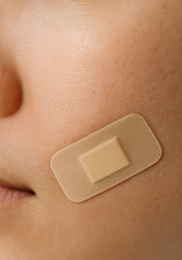 비립종 생기는 이유