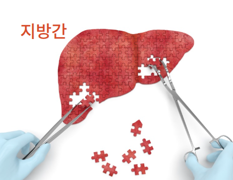 지방간