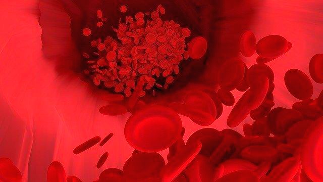 ldl 콜레스테롤 낮추는 방법