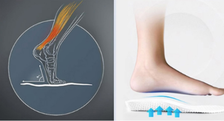 틴플업,틴플업 후기,성장기 인솔 효과,키 성장,자세 교정,키크는법,성장기 보조제,청소년 깔창,틴플업 구매,성장판 자극