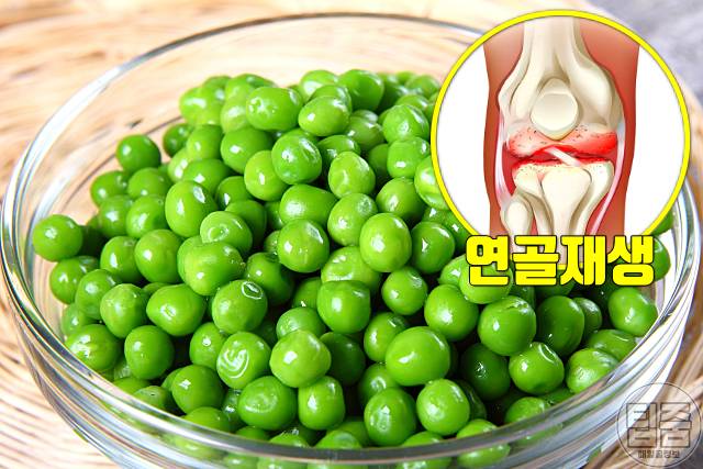 무릎 연골재생 음식 완두콩 무릎연골에 좋은 음식
