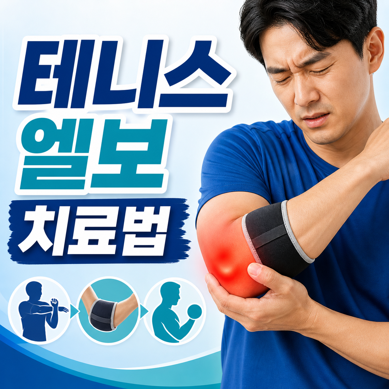 테니스 엘보 치료법