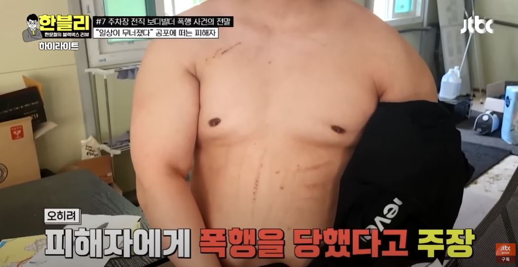 보디빌더 권씨 쌍방폭행 주장