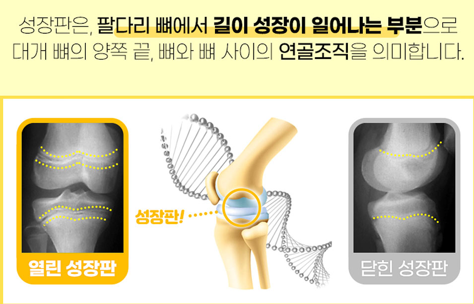 성장판 자극기 '키올리'의 효과와 사용자 후기