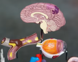 치매 초기증상 8가지 원인과 예방법