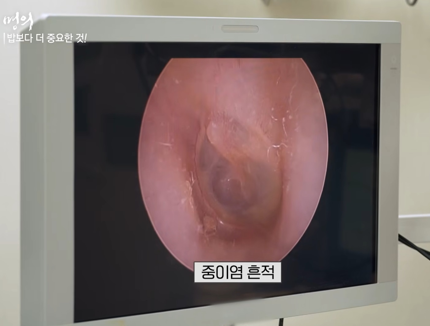 명의-난청-임기정-교수