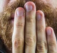 딸꾹질 멈추는 방법