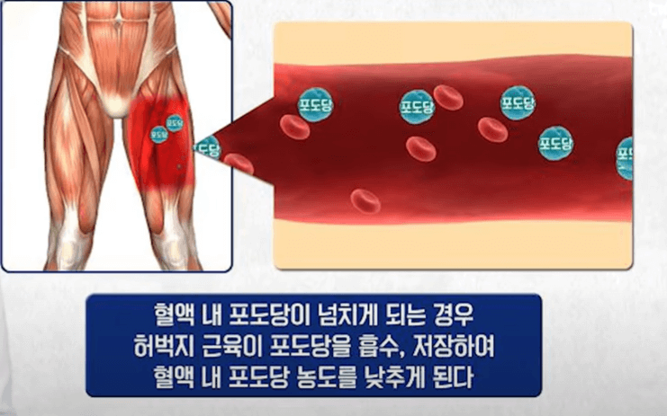 허벅지근육-혈당관리