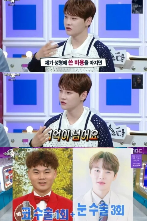 박서진 성형 전후