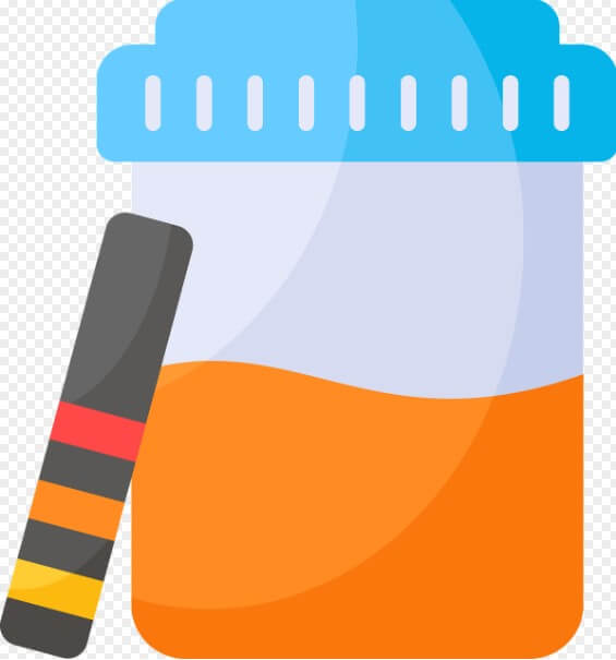 소변을 담아놓은 통