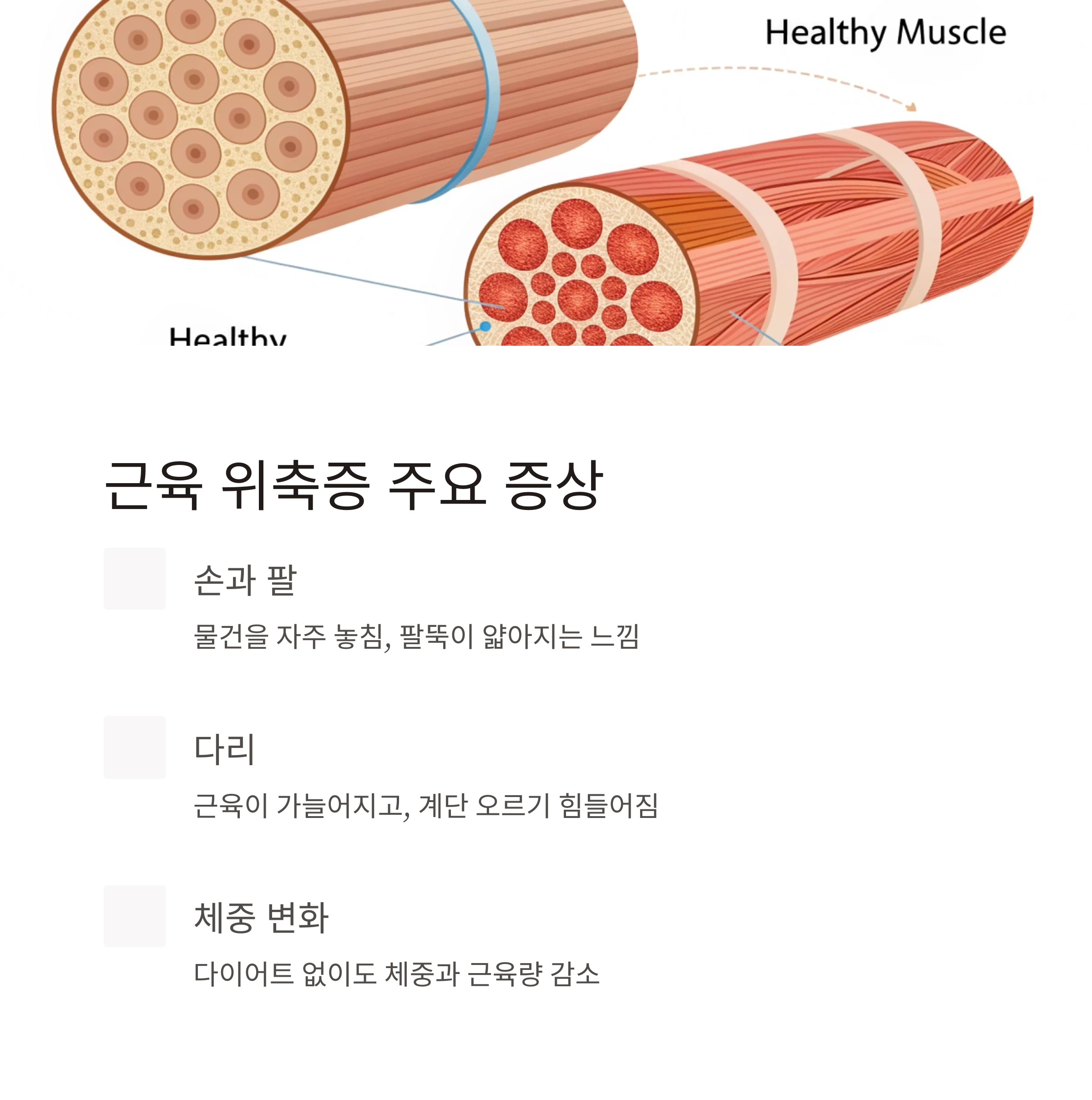 근육 위축증 주요 증상