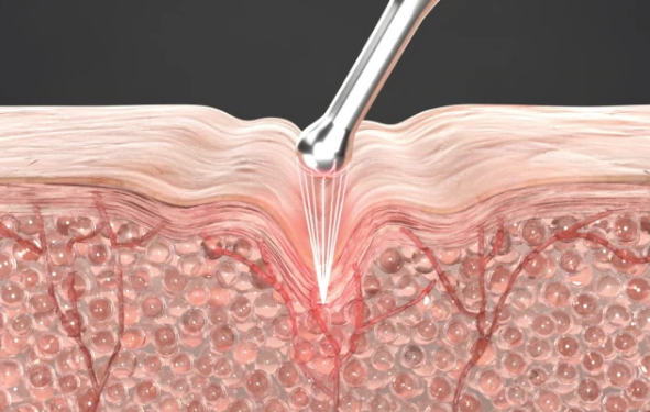 메디큐브 에이지알 아이샷 원리