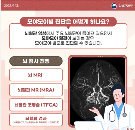모야모야병 진단방법
