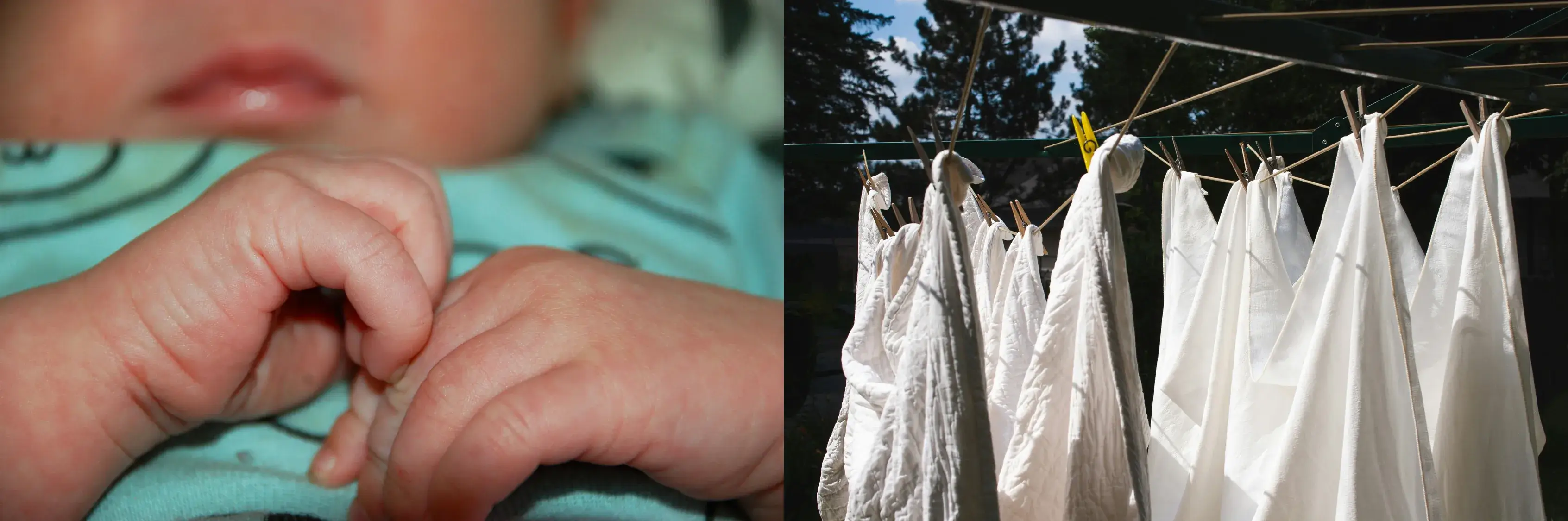 아기 아토피 초기 관리법