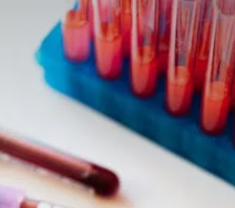 피투성이 당청 꿈 썸네일