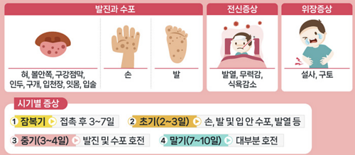 수족구병 증상