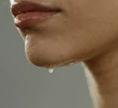 다한증 증상, 원인, 치료방법 완벽 정리: 얼굴, 겨드랑이, 수족다한증까지