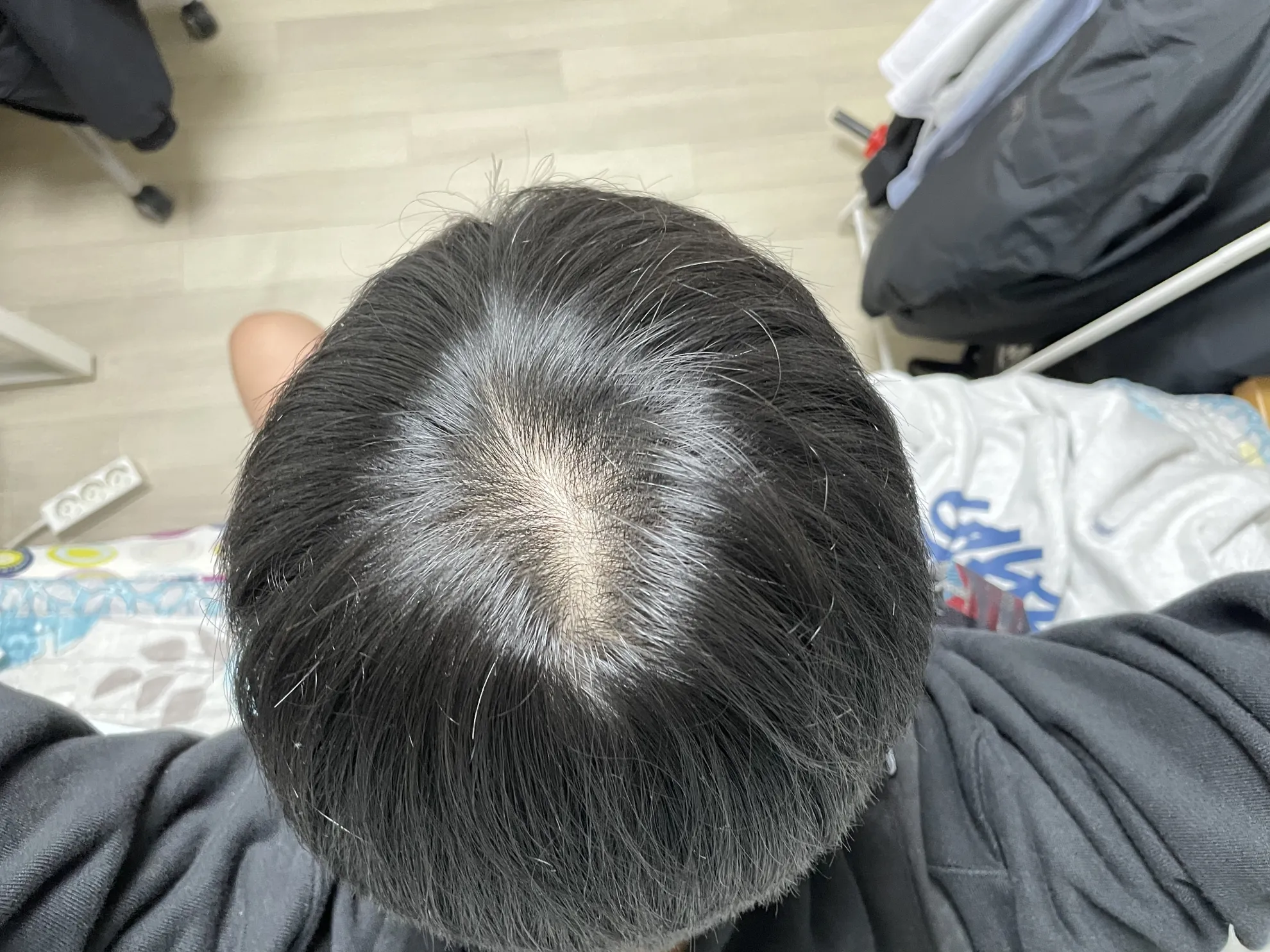 정수리가 아픈 이유와 완화하는 방법_2