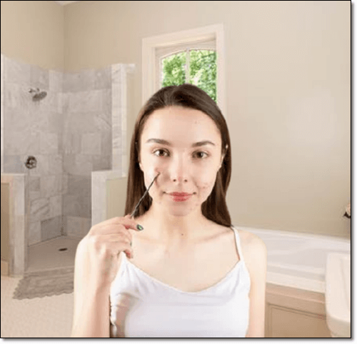 피부염이 있는 여성