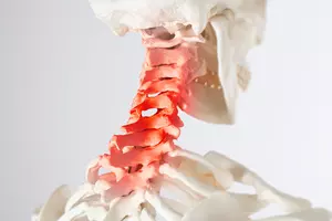 거북목 교정운동