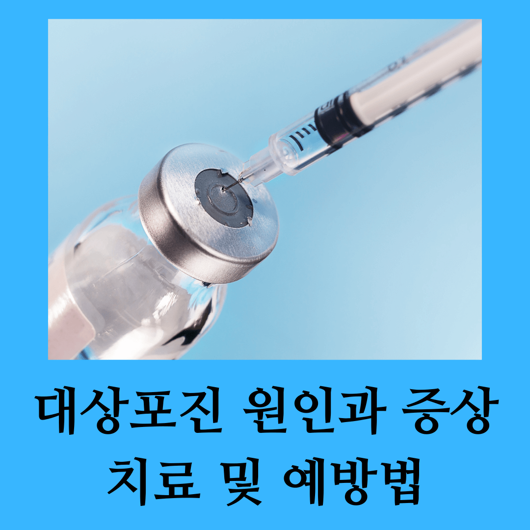 대상포진