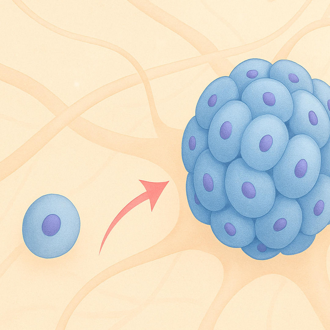 기저세포암 발병 원인과 최신 치료 방법 정리