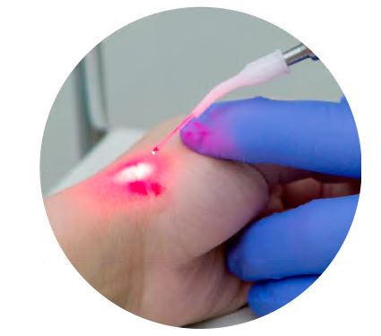 비판텐-연고-효능-효과