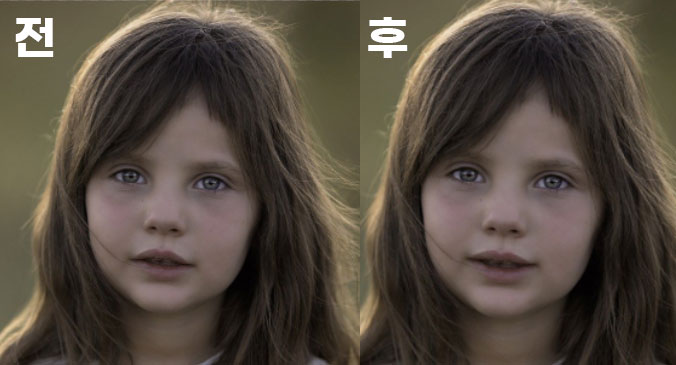 입 꼬리 전 후 이미지