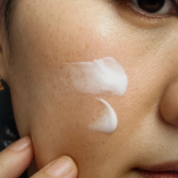 동아제약-멜라논크림-가격-사용법-효과-처방-후기-글-작성위해-찍은-내-얼굴