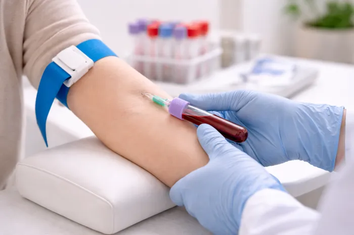 피부에 멍이 잘드는 이유