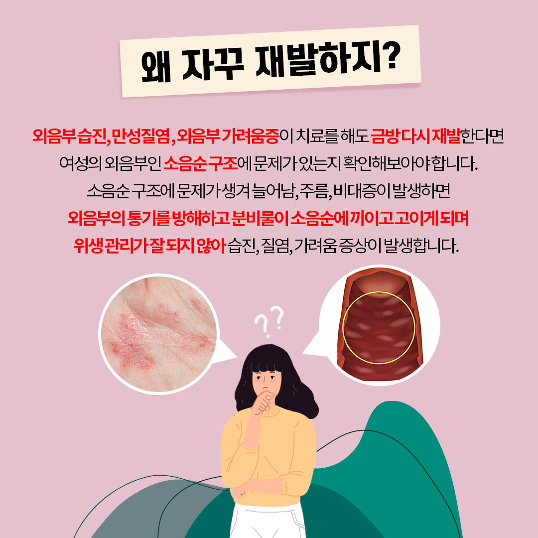 선릉산부인과 만성질염 소음순 때문일까?
