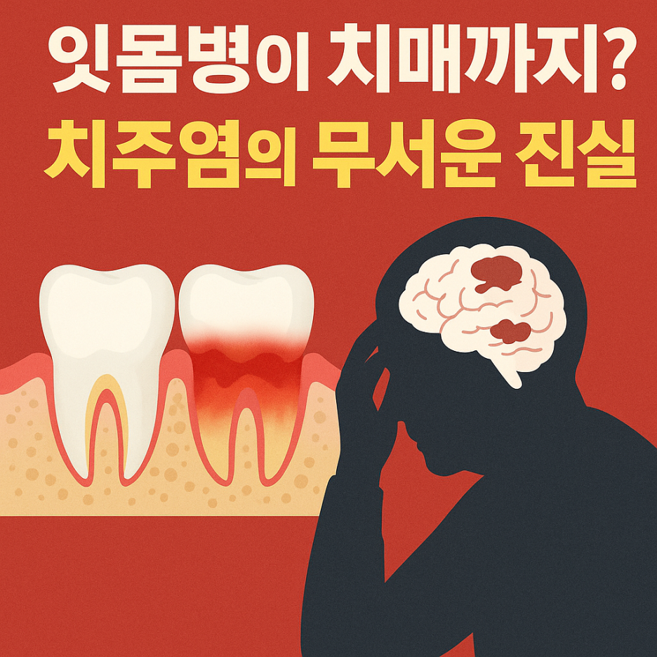잇몸병이 치매까지? 치주염의 무서운 진실