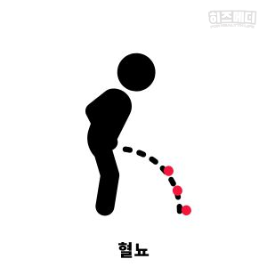 고혈압 증상 원인