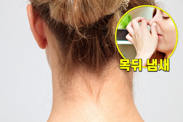 목뒤 냄새, 정수리