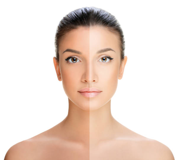 화이트 태닝 이미지