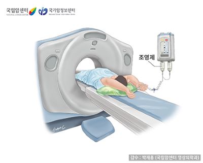 CT조영제검사