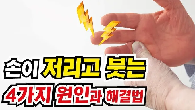 손등 붓는 이유 혈액순환 문제 증상과 해결법 정리_4