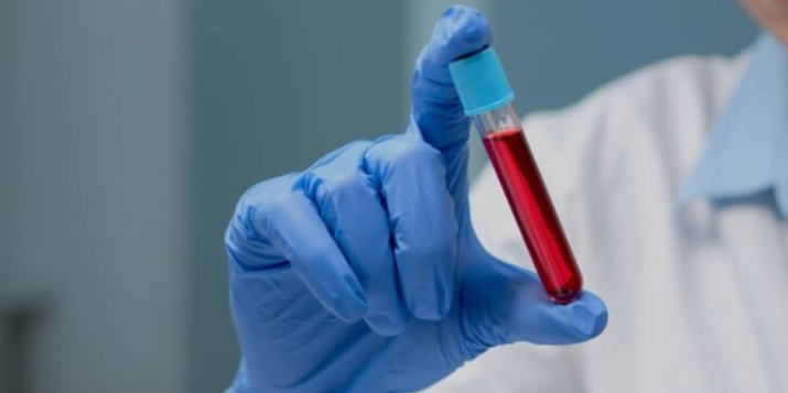 건강검진-금식시간