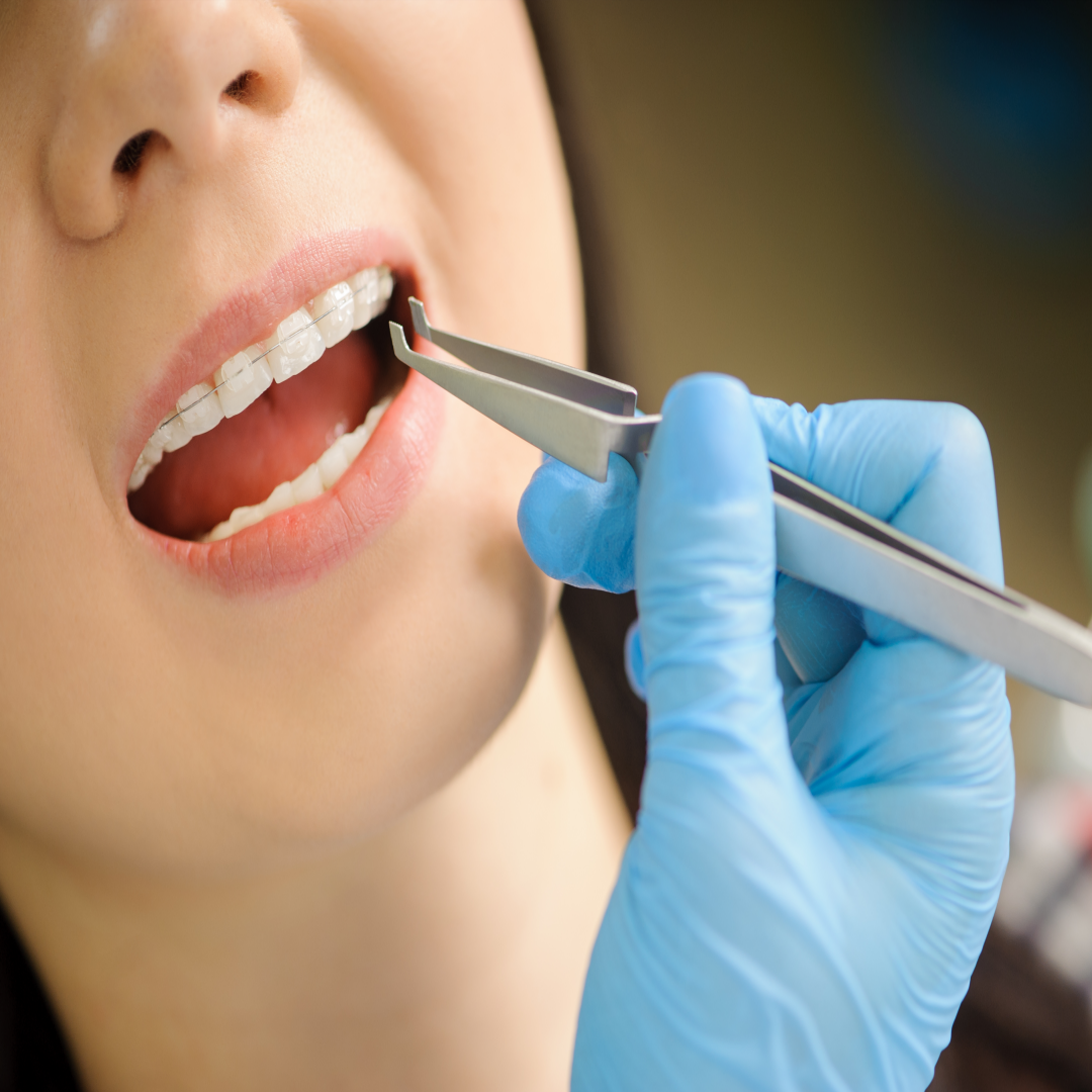 요즘 젊은 층 잇몸병 증가 이유 흡연, 음료, 불규칙한 양치