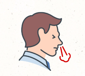 축농증 증상, 치료, 예방법