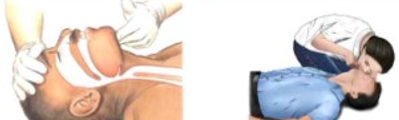심폐소생술(CPR) 순서와 방법<출처:소방청>